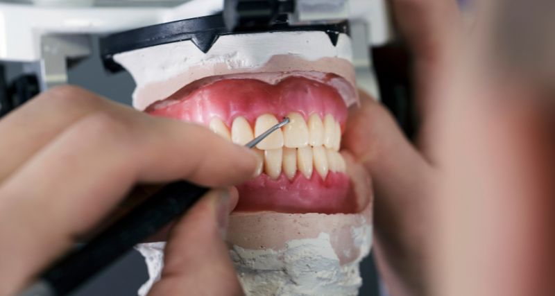 Cómo se fabrican las prótesis dentales